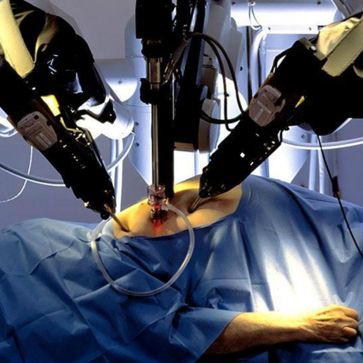 Da Vinci, el robot que realiza cirugías en México