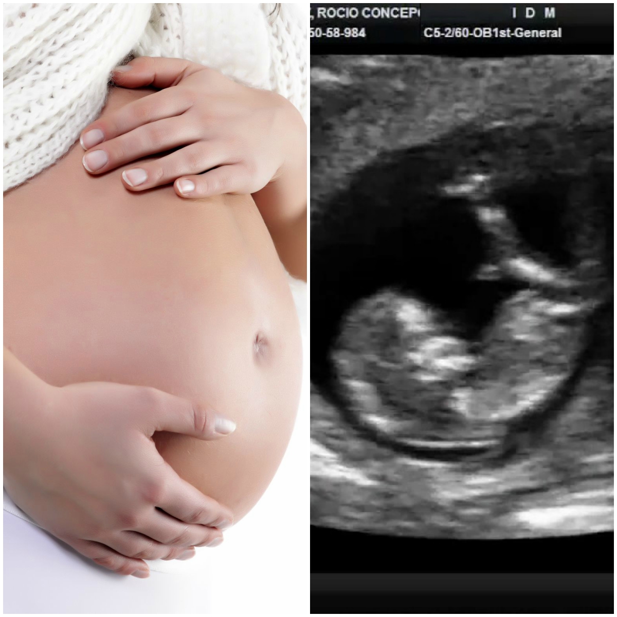 Mexicanos crean dispositivo que monitorea el sufrimiento fetal y evita muertes prematuras