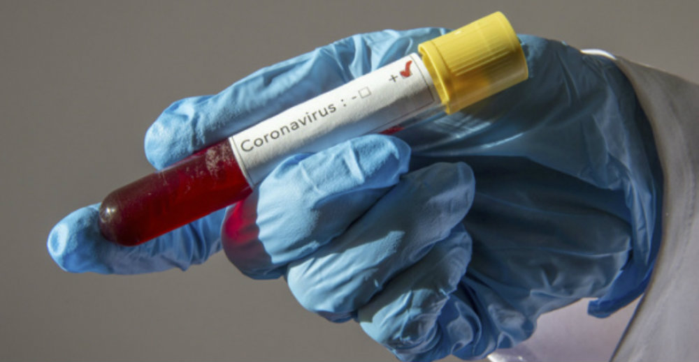 Tras discutir con su novio, lo acusa de tener coronavirus