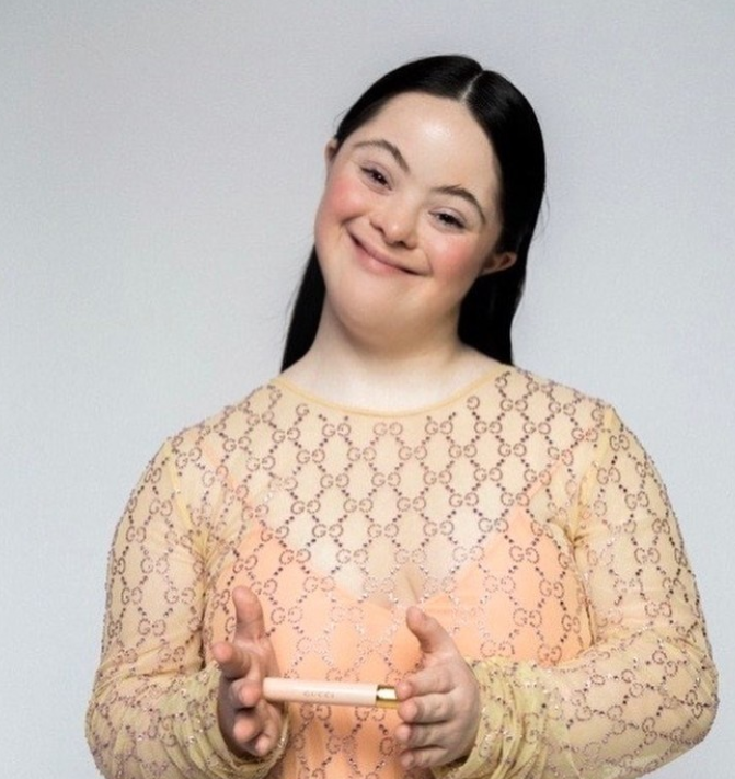 Modelo con síndrome de Down rompe estereotipos en campaña de Gucci