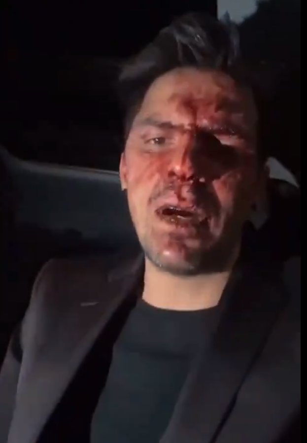 Hijo de Lupita D'Alessio acusa a Arturo Montiel y a su hijo de golpearlo