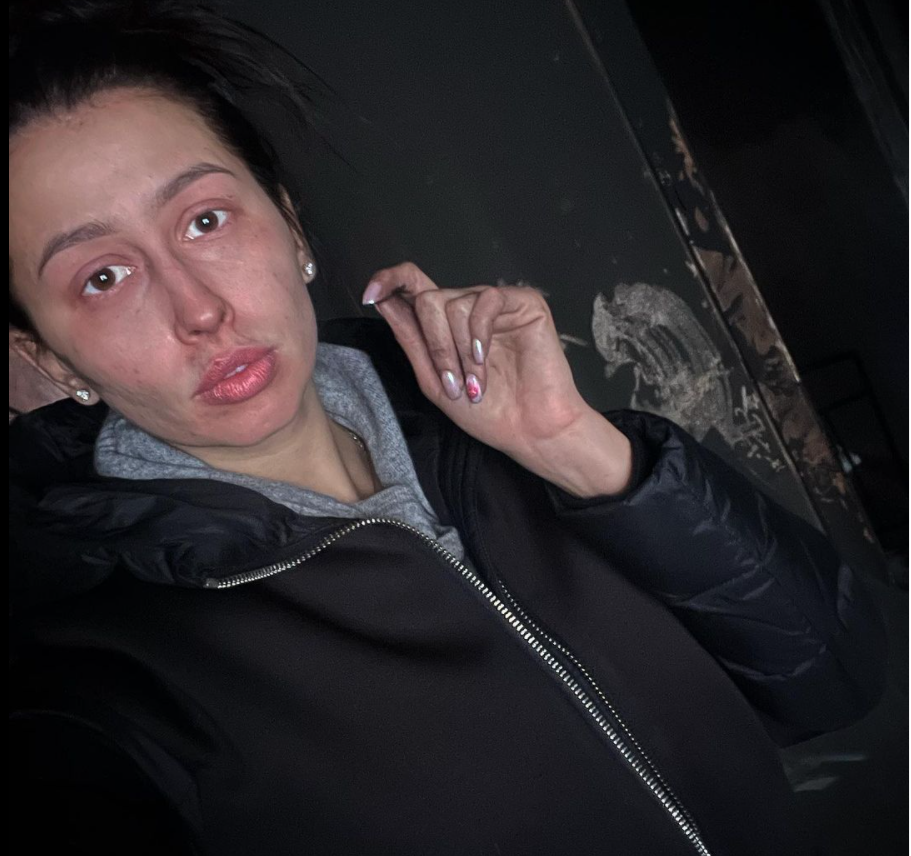 Gimnasta pierde su casa en incendio; no olió el humo porque tenía covid