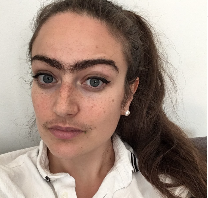 Joven muestra su cambio tras un año sin depilarse