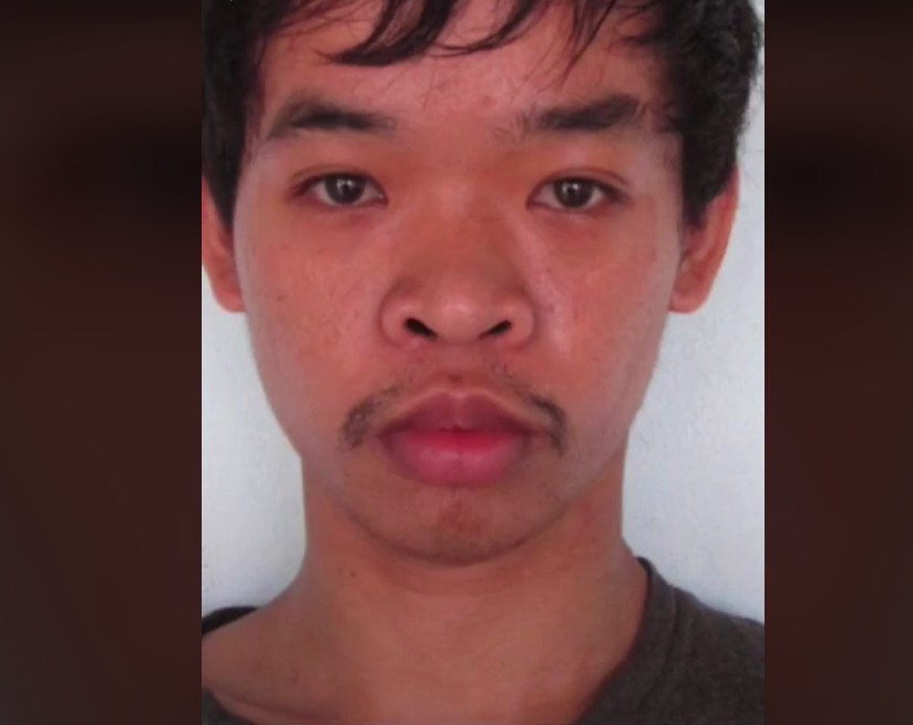 Joven se hace nueve cirugías plásticas tras ser rechazado de un trabajo