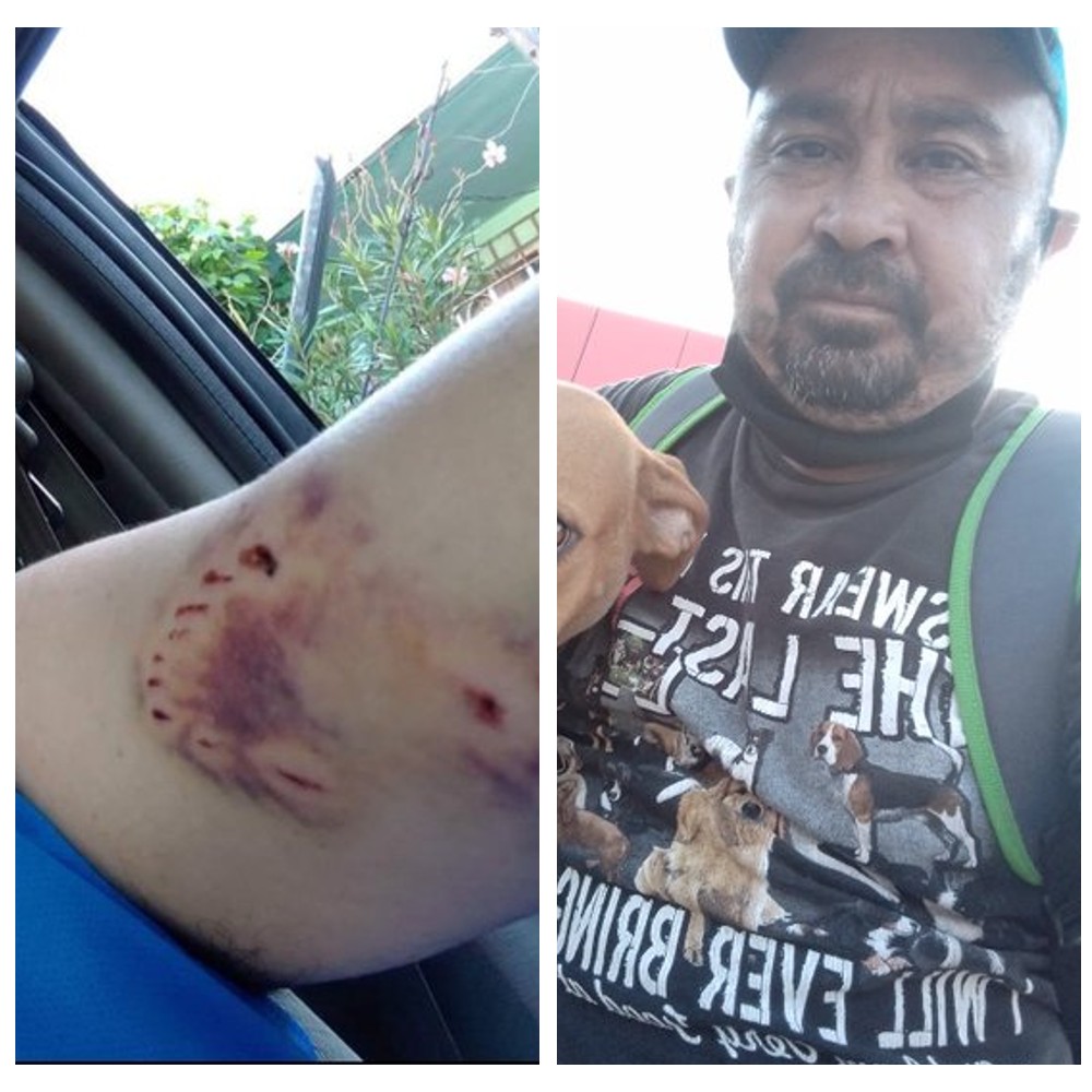 Hombre rescata a una perrita callejera que le mordió el brazo