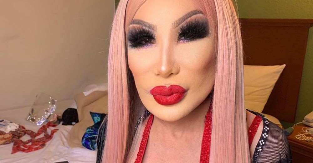 Lyn May invita a ponerse botox pese a quedar desfigurada en un tratamiento