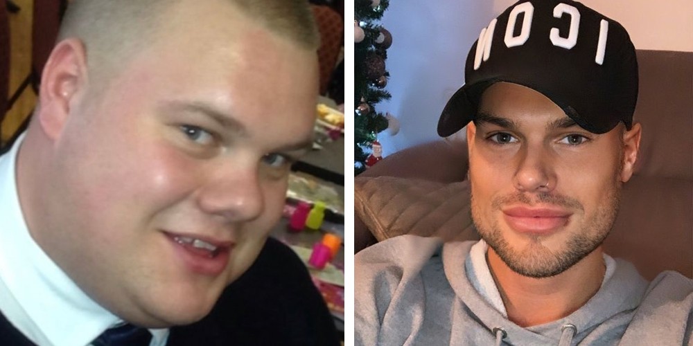 Gasta 700 mil pesos en cirugías estéticas para verse como en sus fotos de Instagram