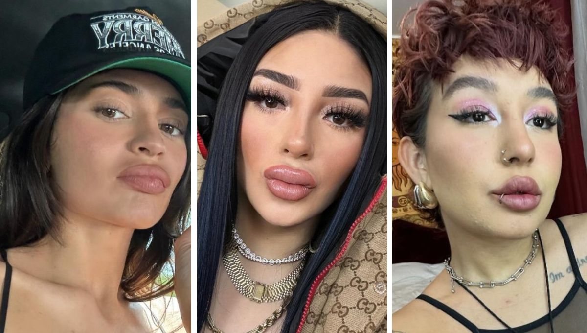 Famosas que abusaron del ácido hialurónico en los labios