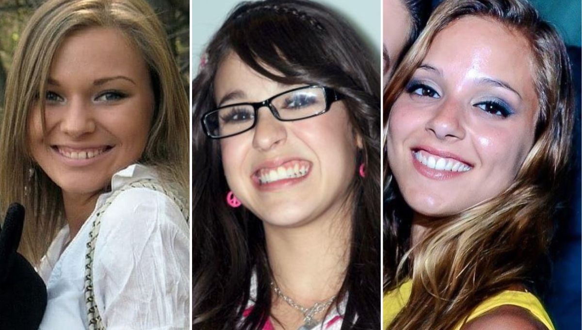 El antes y después de las famosas que se pusieron carillas dentales