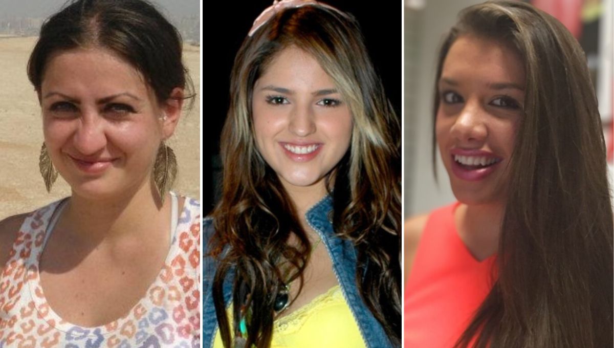 El antes y después de las famosas que se hicieron la rinoplastia