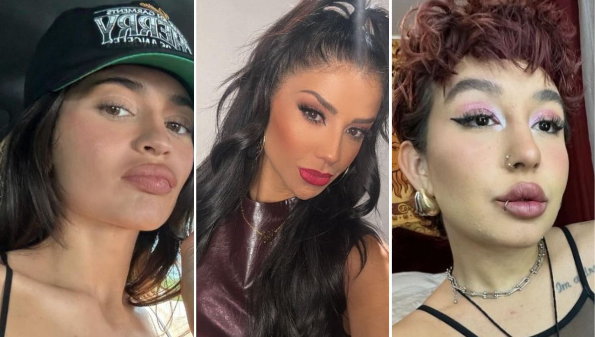 Famosas que se arrepienten de ponerse rellenos de ácido hialurónico