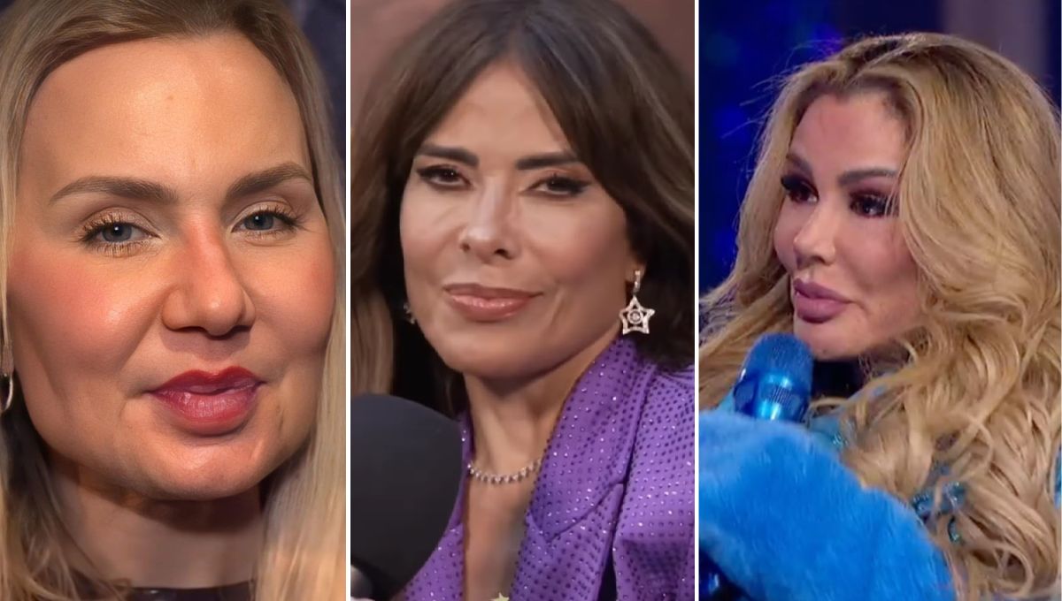 Famosas que abusaron del bótox y ácido hialurónico