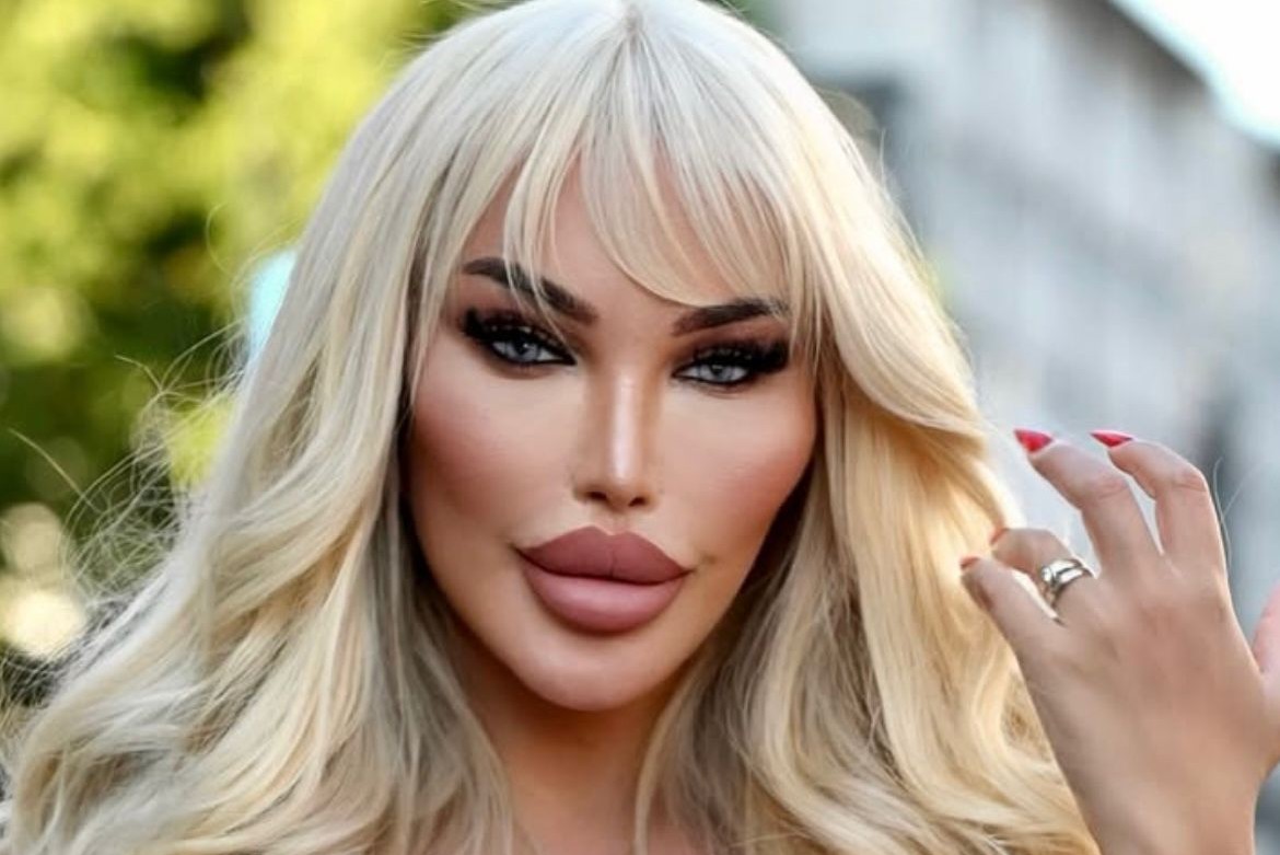 Así lucía Jessica Alves "La Barbie humana" antes de su cambio de género