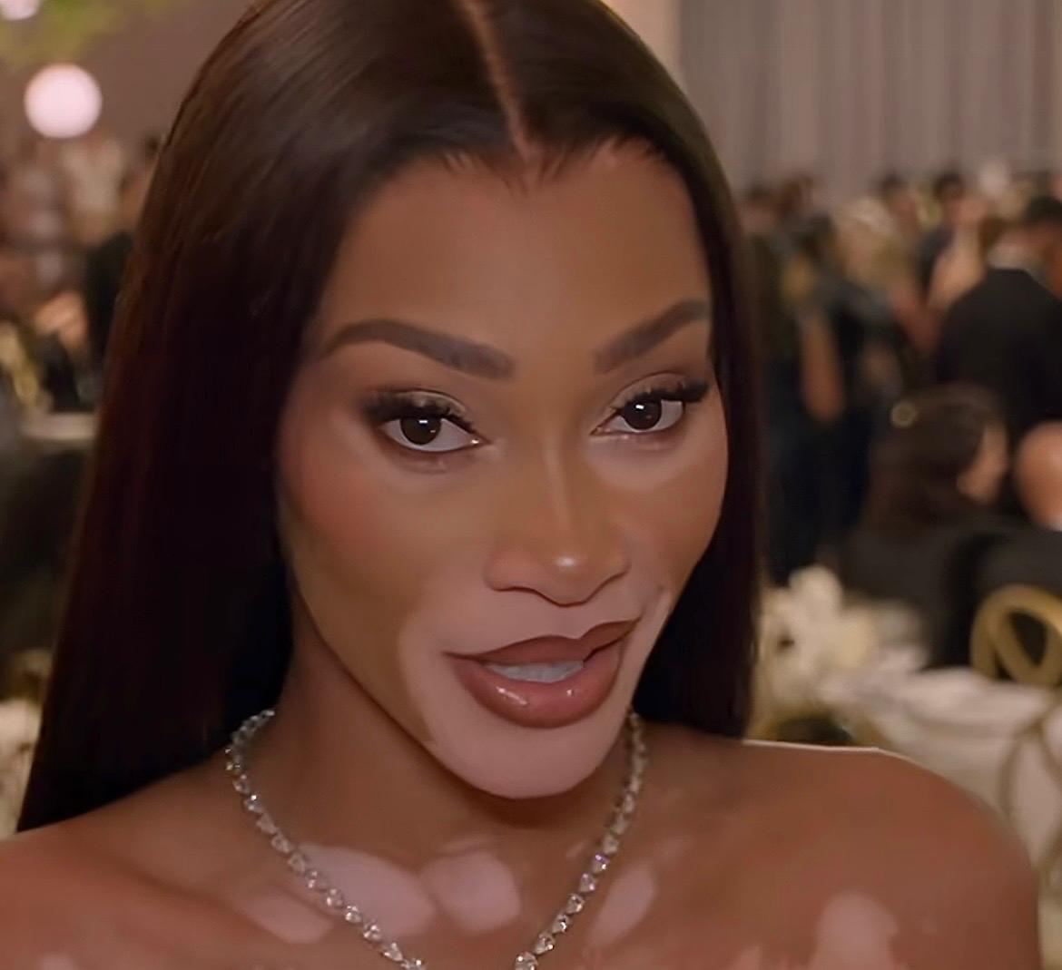 Winnie Harlow