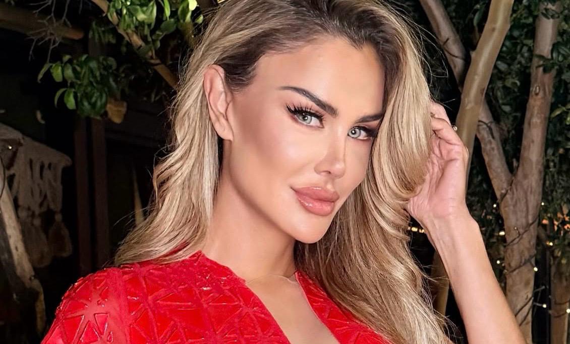 Este es el antes y después de Ninel Conde