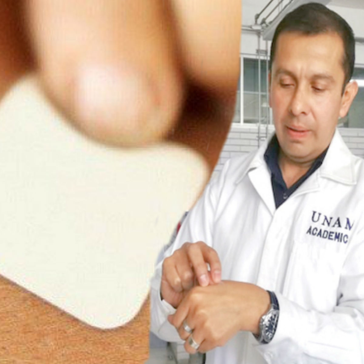 Científico de la UNAM desarrolla parche que combate la obesidad